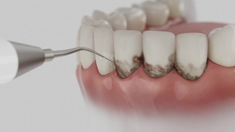 Trusted Root Canal Treatment service in Grant City, MO - Dentist Open Now